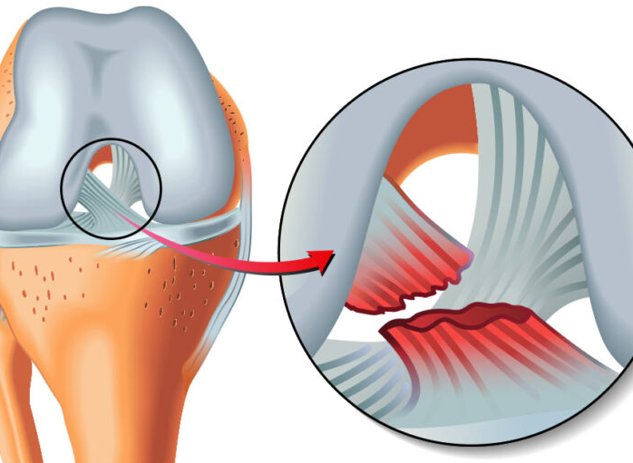 Lesiones esquí y snow